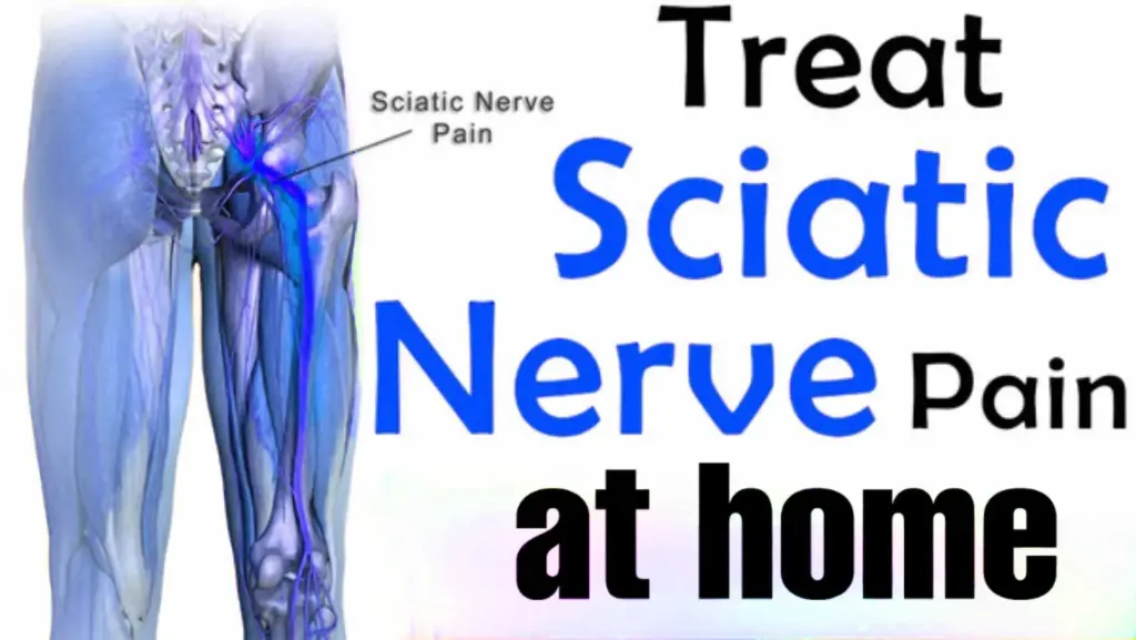 treat sciatic never pain at home