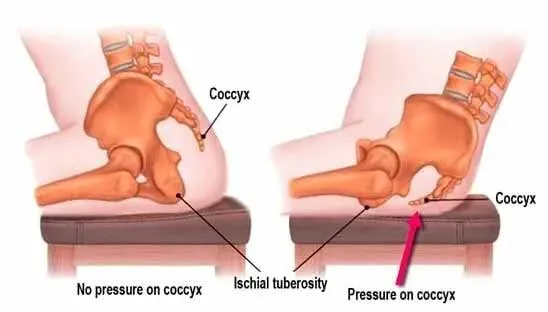 no pressure on coccyx & pressure on coccyx