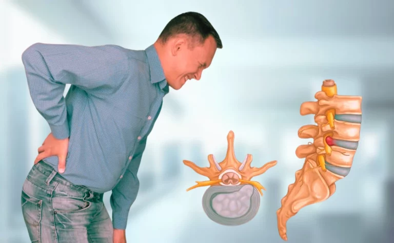 Lower back pain