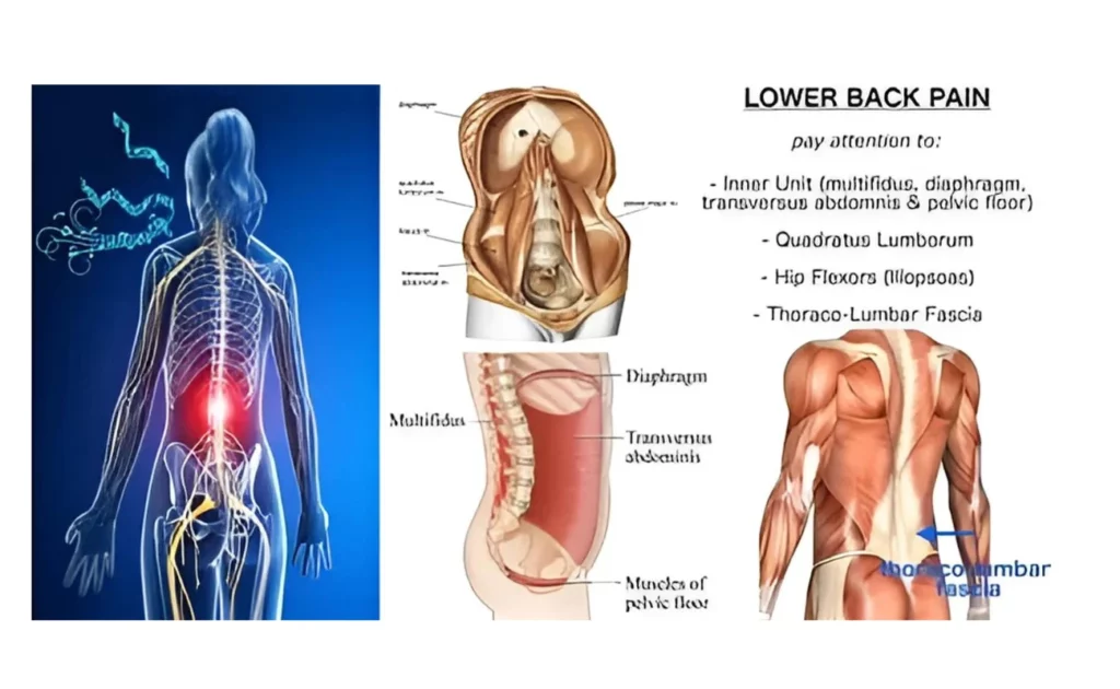 Vertebral Compression Fracture