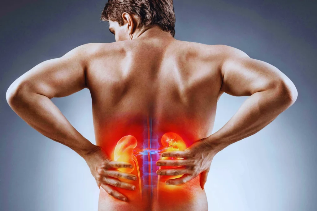 Kidney and Bladder Infections in men