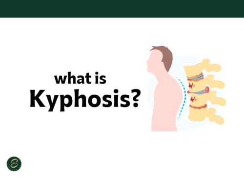 what is kyphosis