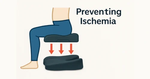Preventing Ischemia